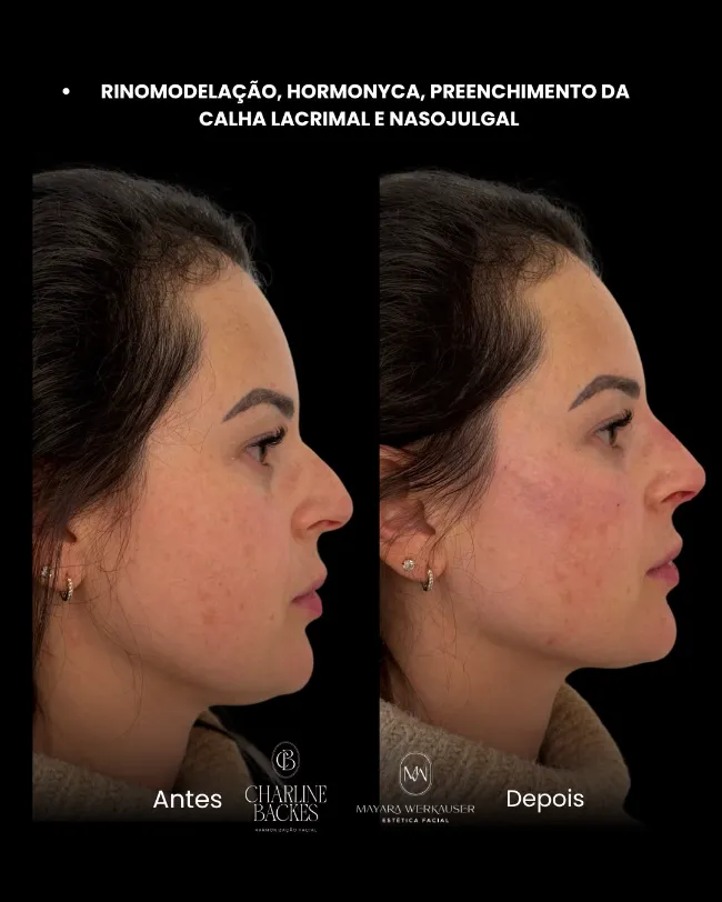galeria_nova_HhYZimhfqgFk.webp