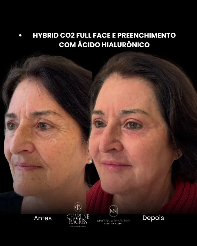 galeria_nova_q0xmpG1HNpac.webp